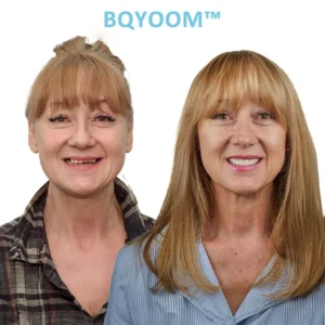 BQYOOM™ GelFit Dentures