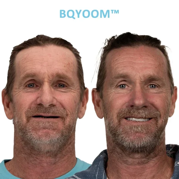 BQYOOM™ GelFit Dentures