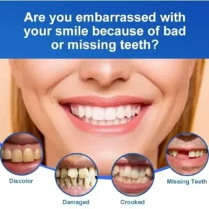BQYOOM™-🦷Advanced Customized Full Denture Set🦷