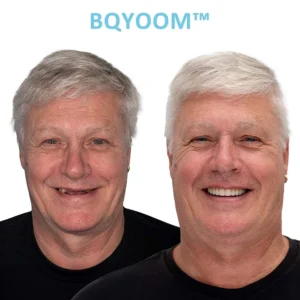 BQYOOM™ Dentures Invisible Comfort, Natural Grip