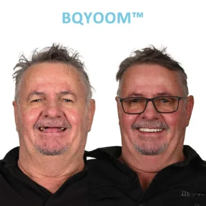 BQYOOM™ Dentures Invisible Comfort, Natural Grip