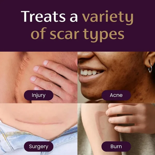 BQYOOM™ Advanced Scar Gel