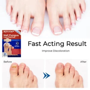 BQYOOM™ Nail Fungus Care Patches