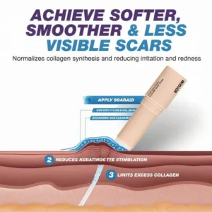 BQYOOM Silicone Scar Stick - For Face and Body