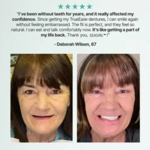 SEAGRIL™ Custom-Fit Full Functional Dentures