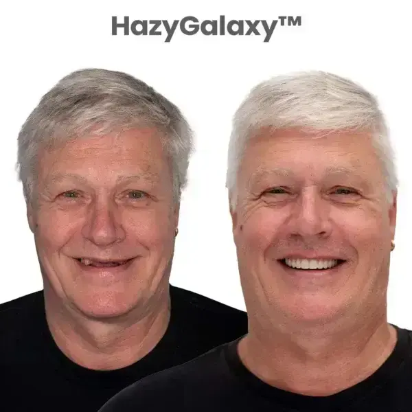 🎁🦷 HazyGalaxy™ Custom-Fit Smile Support Set ⏰ ENDS TODAY 49% OFF | Smile with Confidence😉