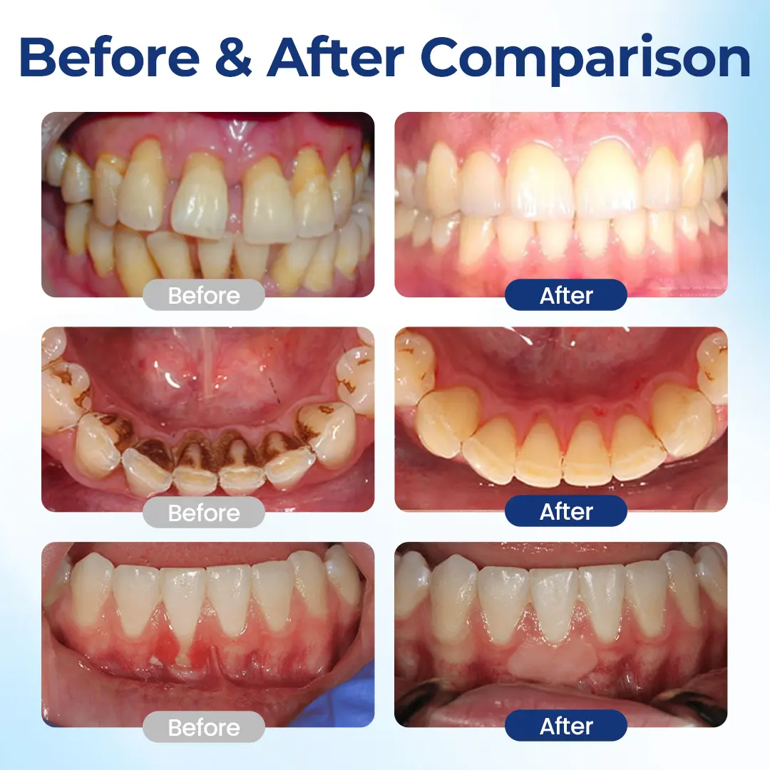 LIMETOW® BeeTakt Oral Repair Solution