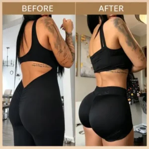 NEYEROS® Breast Enhancement Nano Microneedle Patch | Targeted Bust & Glute Care
