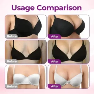 NEYEROS® Breast Enhancement Nano Microneedle Patch | Targeted Bust & Glute Care