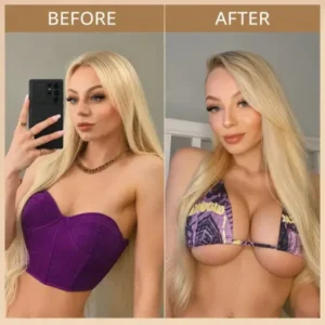 NEYEROS® Breast Enhancement Nano Microneedle Patch | Targeted Bust & Glute Care