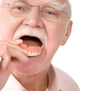SmileForm™ – Full Denture Set