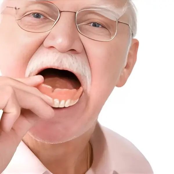 SmileForm™ – Full Denture Set