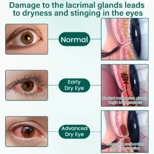Visiora™ OptiClear Nano Eye Roller Serum